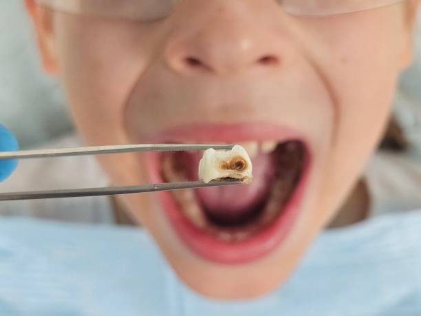 Best Broken or Cracked Tooth Emergency Dentist in Bell Gardens, CA